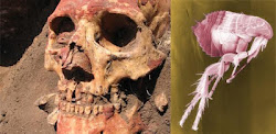 Plague In Humans May Be ‘Twice As Old’ But Didn’t Begin As Flea-borne, Say Cambridge Research