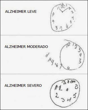 Test del reloj para detectar la demencia - Comunicación y Demencias