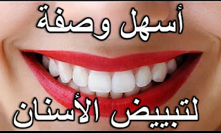 افضل الطرق لتبيض الاسنان افضل الطرق لتبيض الاسنان