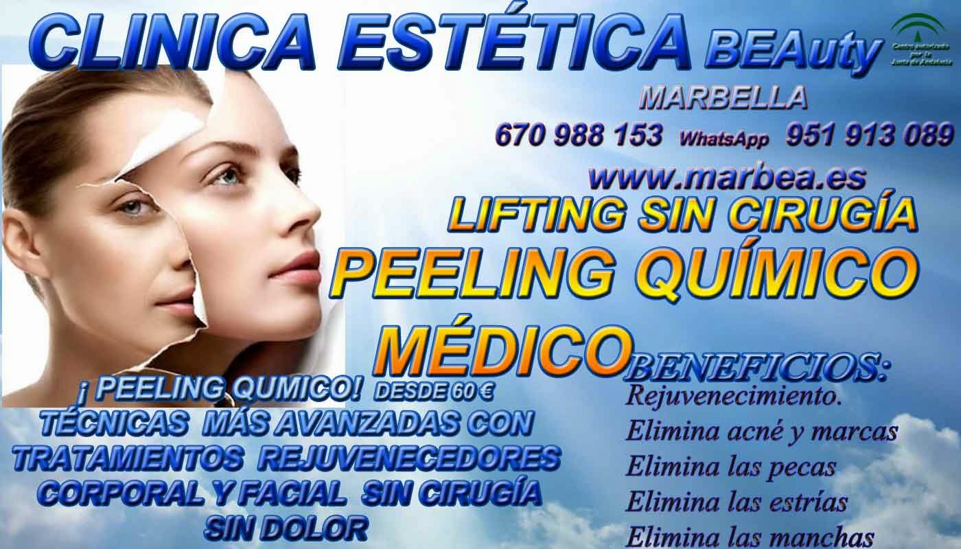 MARBELLA PEELING FACIAL QUIMICO MARBELLA PEELING FACIAL QUIMICO MEDICO PARA ELIMINACIÓN , QUITAR , TRATAMIENTO: ACNÉ , MARCAS , CICATRICES , MANCHAS ,PECAS , ESTRÍAS , MANCHAS