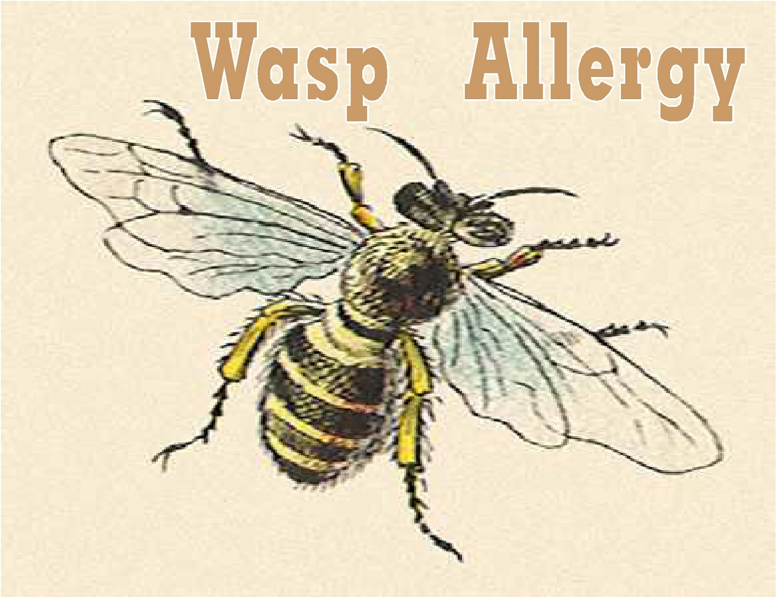 Free Posters and Signs Wasp Allergy