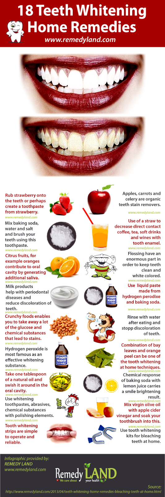 18 Teeth Whitening Home Remedies For Bleaching Teeth At Home - Remedy 
