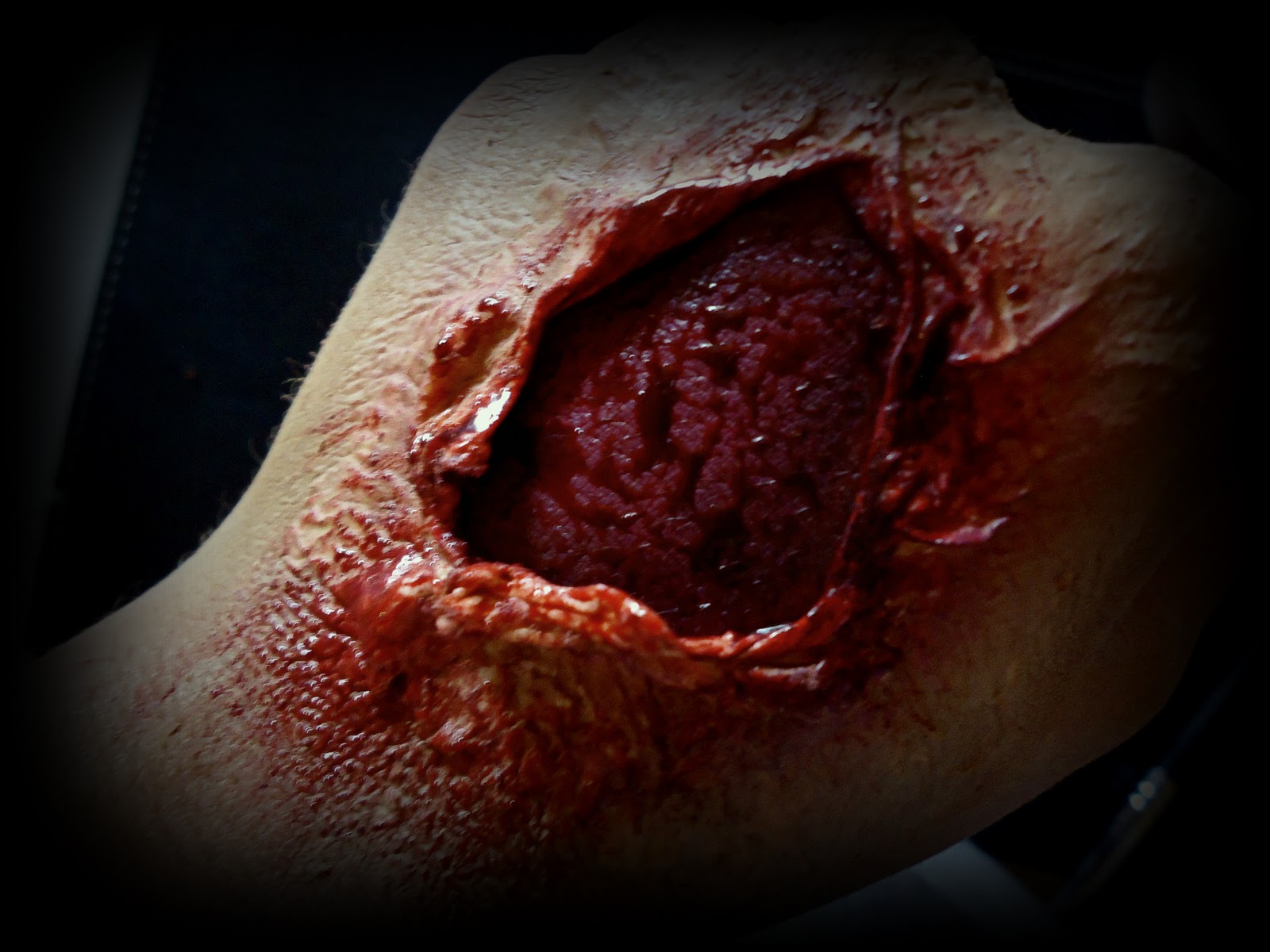 bloody wounds