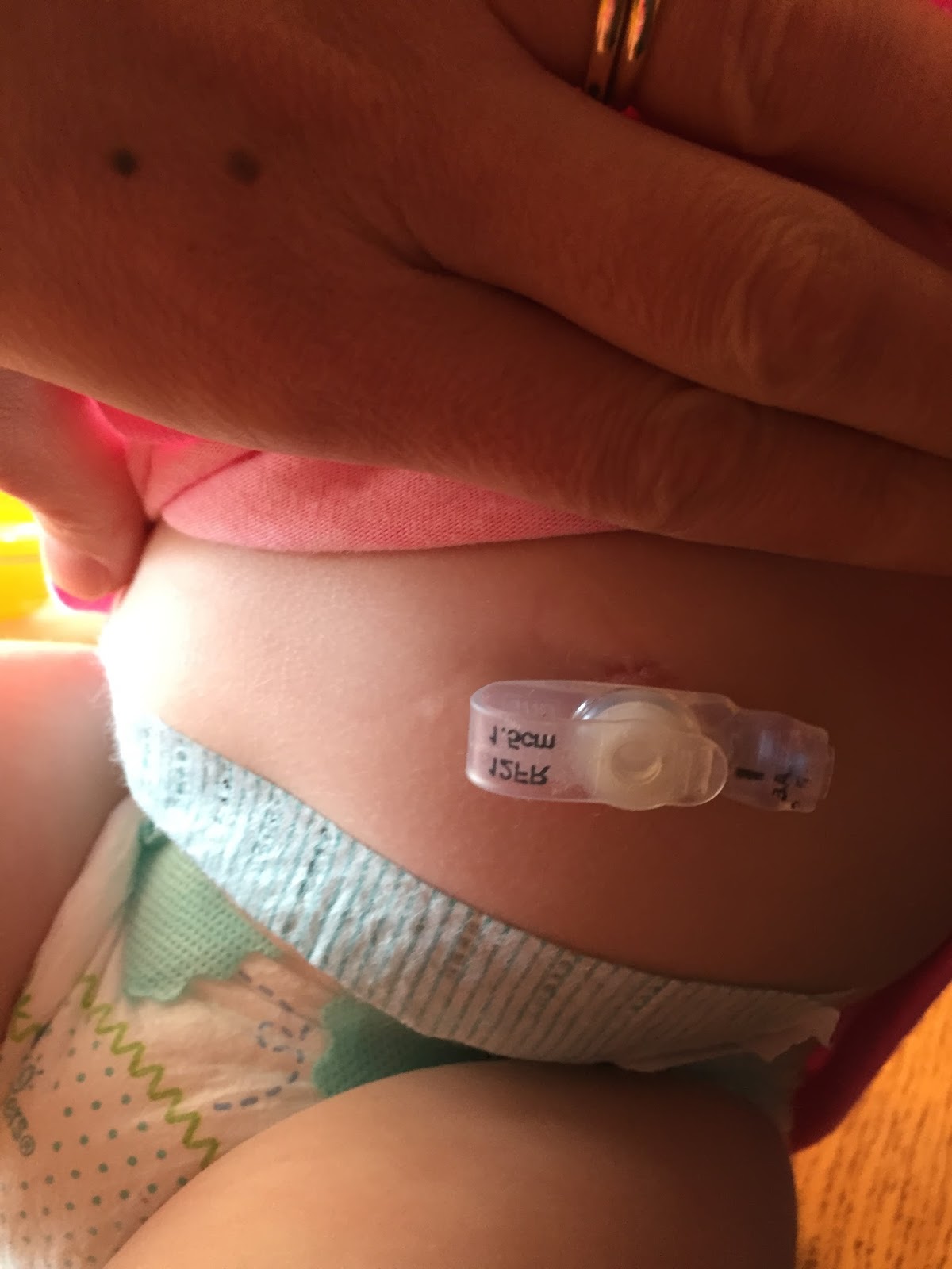 Six Sweet Seals All About Gtubes