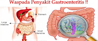 http://sayherbal.blogspot.co.id/2015/10/pengobatan-tradisional-gastroenteritis.html