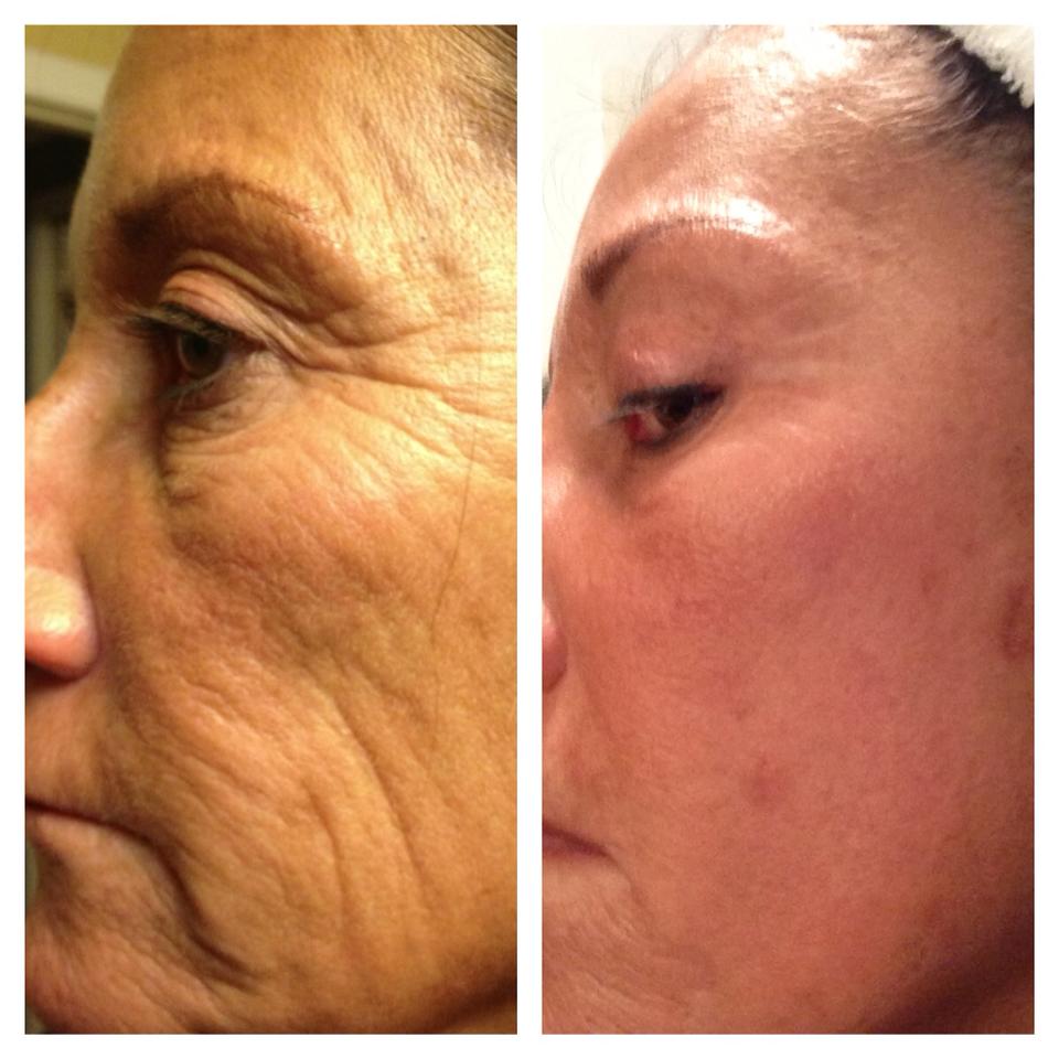 michigan home mommy works neriumad age defying treatment giveaway it works skin care results