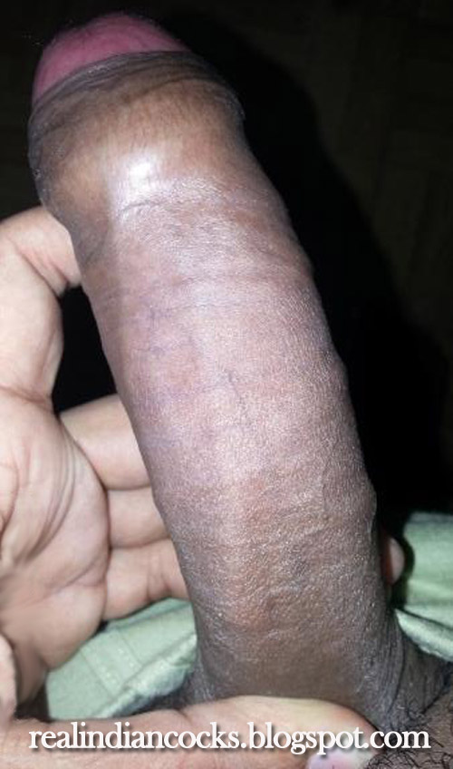 Uncut Penis Galleries 75