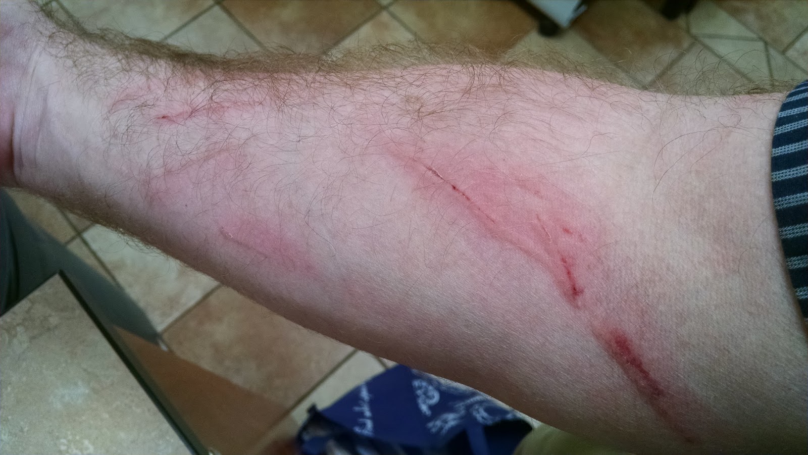 A Vet's Guide To Life Injuries To The Vet