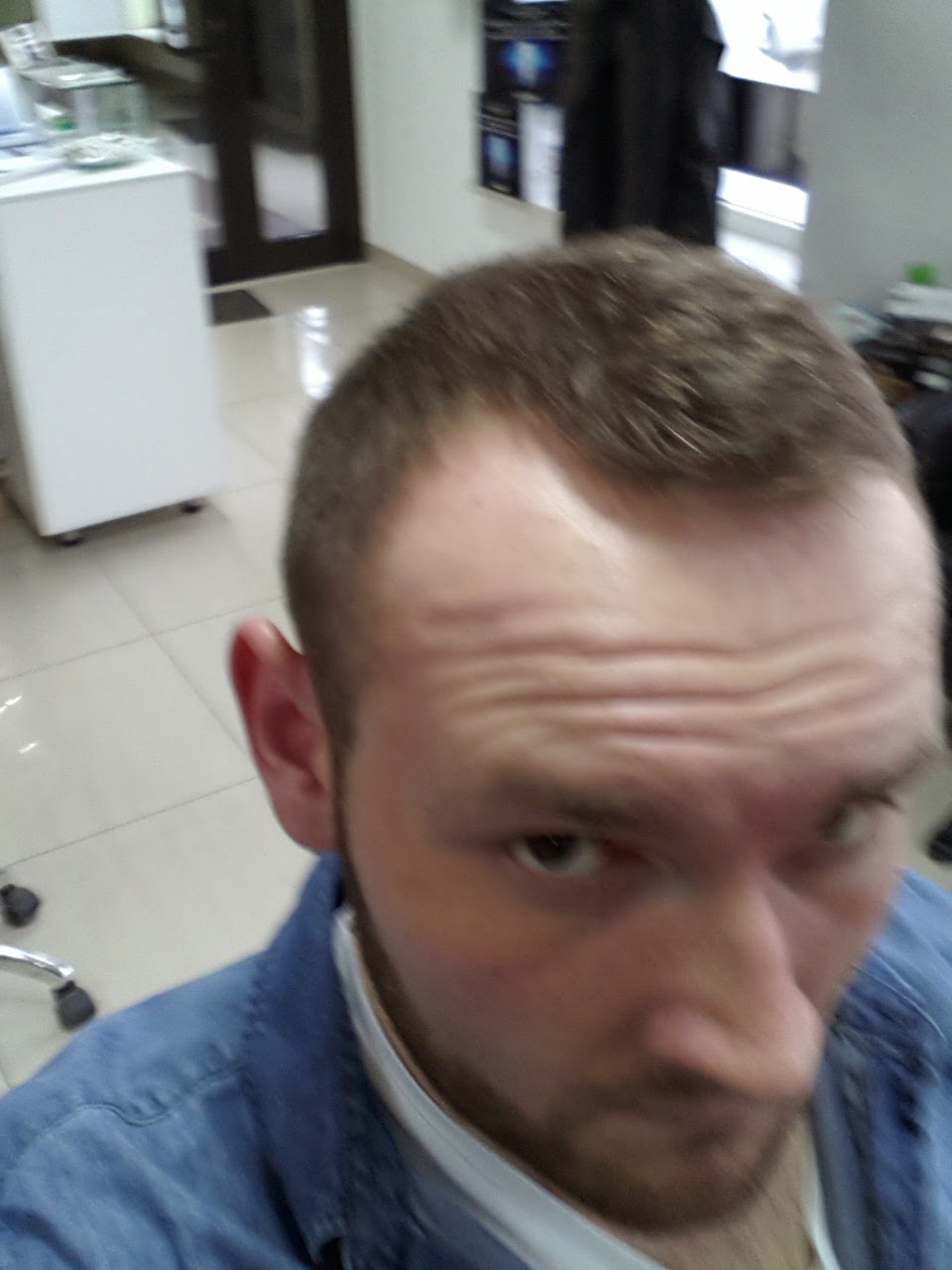 Pracownia Urody Michałewycz Spektakularne Efekty Stosowania Serii