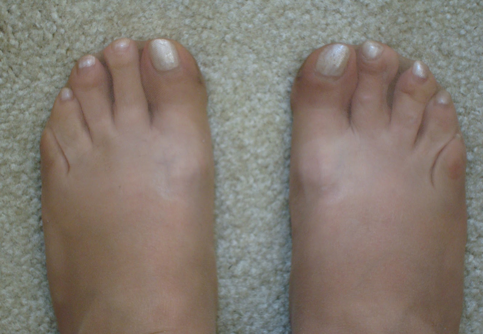 From "Me" to "Mandy" OMG I cracked a nail!