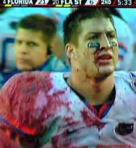 tebow_bloody.jpeg