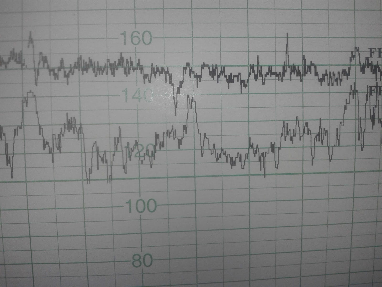 KTG nie ma co panikować