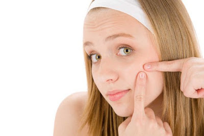 Prescrição cura natural acne