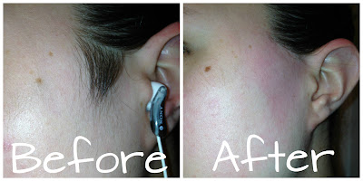 Ladies: How To Get Rid of Your "Sideburns" Ladies: How To Get Rid of Your "Sideburns"