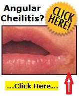 HOSE BABE PANTYHOSE VIDEOCLIPS HOSE Herpes Pictures In Mouth