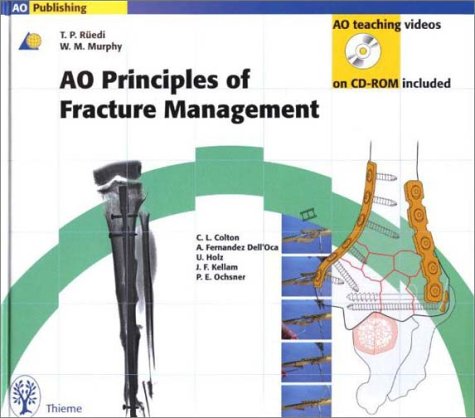 Ao Principles of Fracture Management 