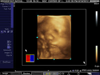 Preslie's 4D Sonogram