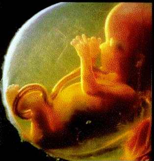 Aborto: Sí, No y Por qué? DIOS+ES+EMBRI%C3%93N+HUMANO