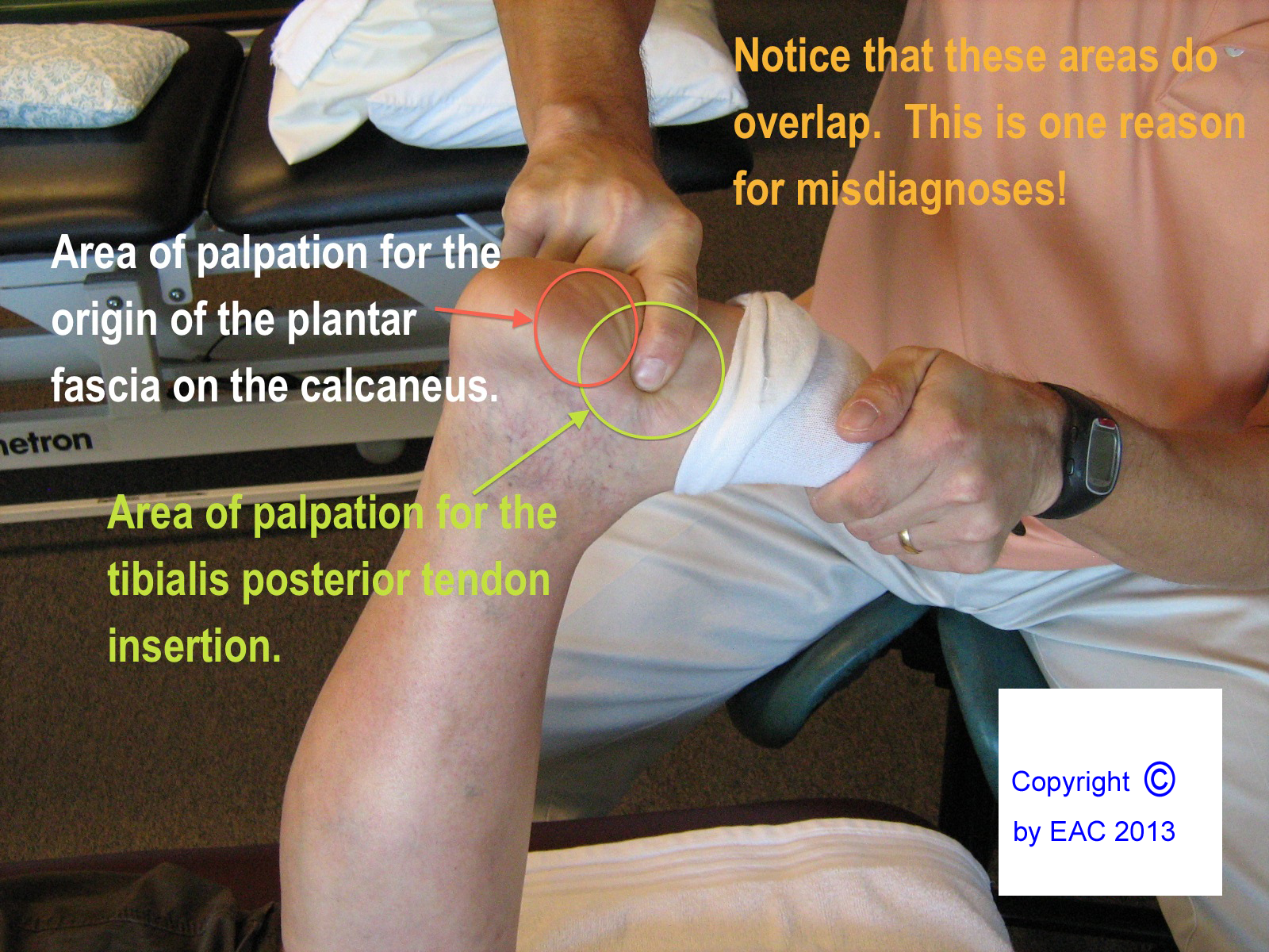 Endurance Athlete Consulting by Senska Physical Therapy