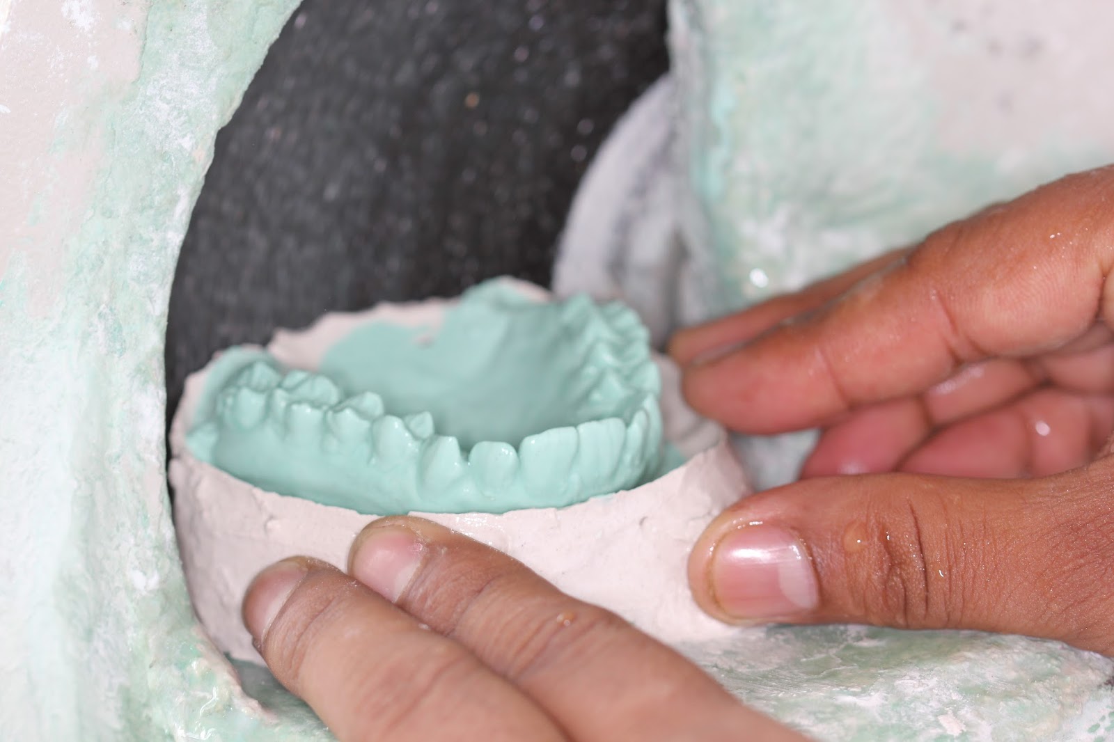 Step by step Guide for Understanding the Prosthodontics Making of