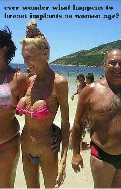 brazilian but lift nederland