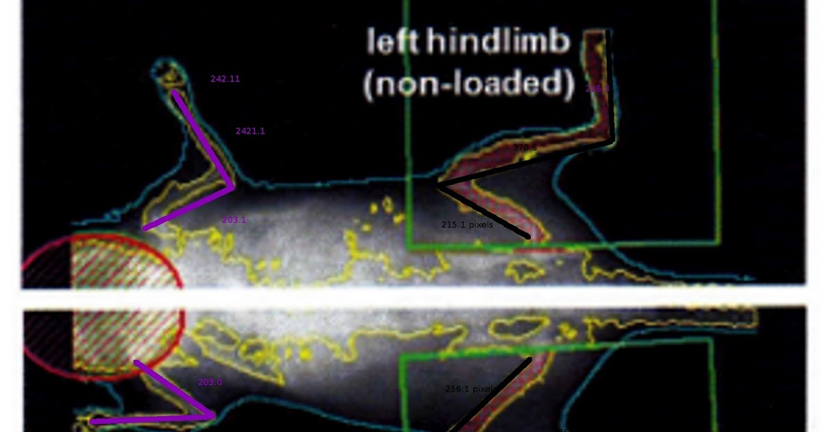 The Quest for Height Grow Taller Increase Height Bone Size