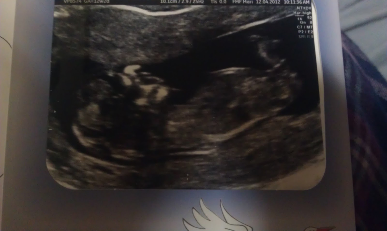 Can dating scan at 4 weeks