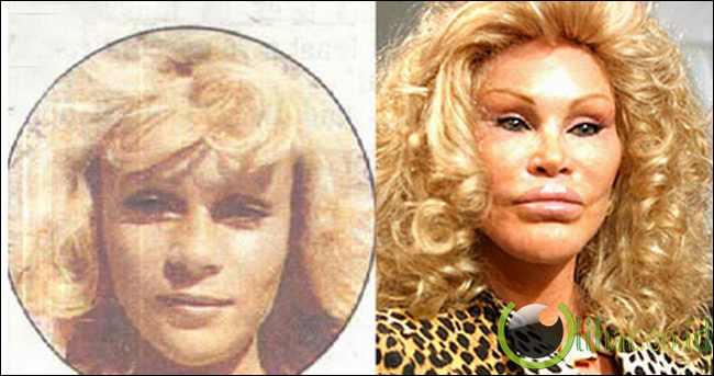 Jocelyn Wildenstein Jocelyn Wildenstein