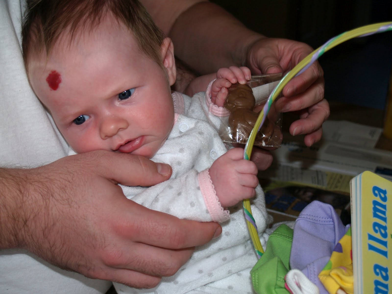 Stork Bite Vs Strawberry Mark