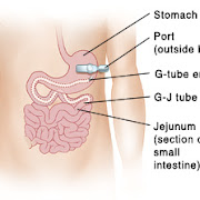 Blood group o diet plan image 10