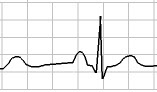 Simulador ECG