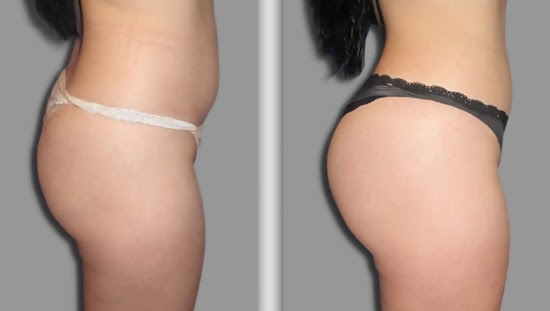 [Image: nang-mong-6.jpg]