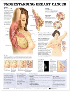Kanker+Payudara.jpg