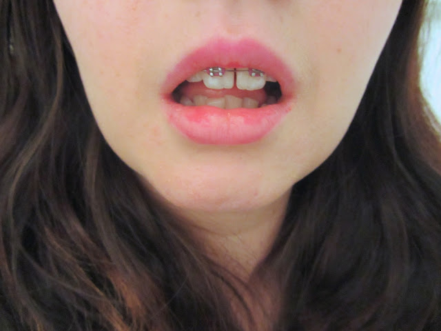 Roxy, a girl with braces poses after a day of wearing Revlon Just bitten Kissable in colour Lovesick to show how it has slightly worn away after 6 hours of wear
