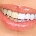 10 طرق طبيعية للحصول على أسنان بيضاء
