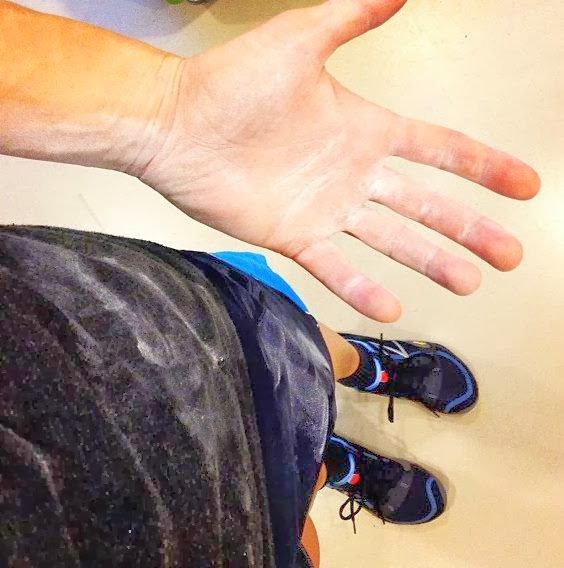 Bruises and Calluses About