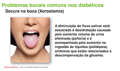 secura na boca, xerostomia, diabetes, doenças comuns