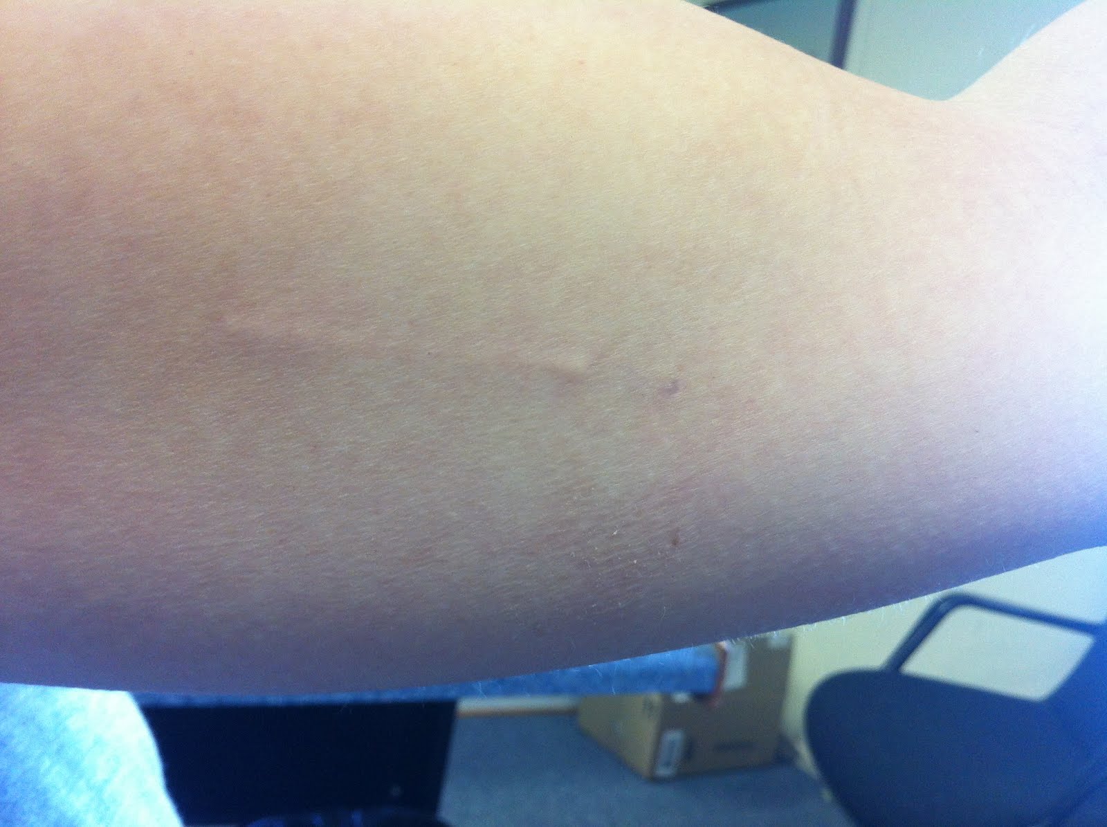 "I'm not heartless, I'm just ruthless." Implanon