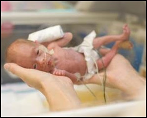 gestational age baby - Main Image