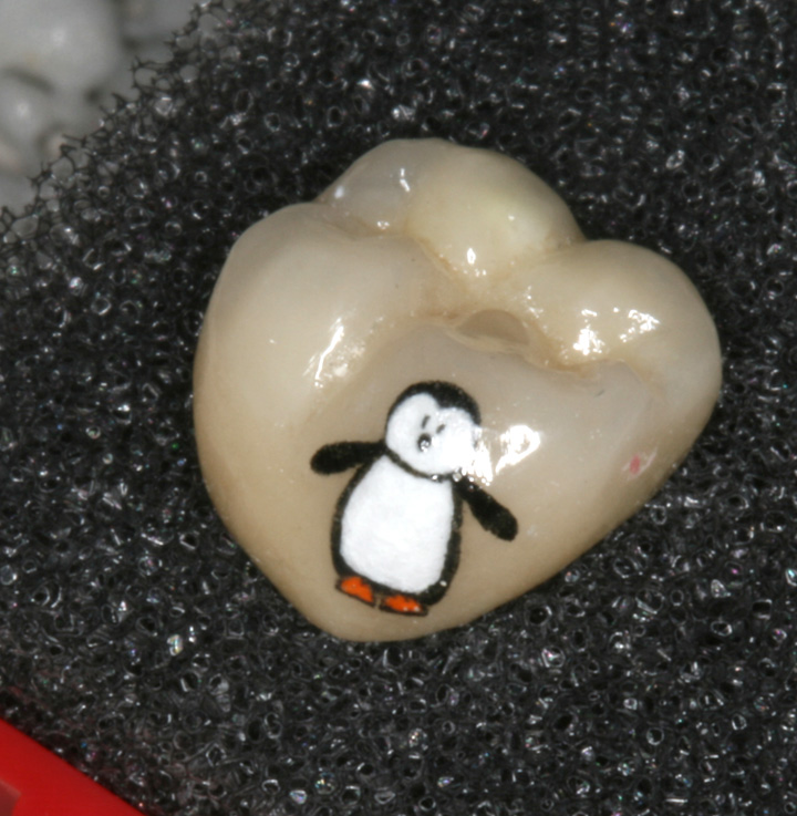 Latest Trend Dental Tattoos New Graffiti 2012