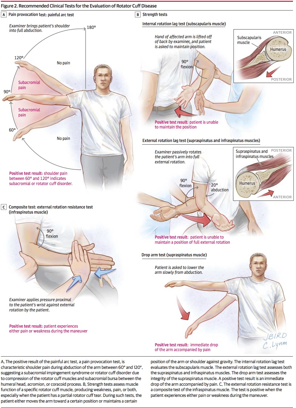Hospitalist なんでも無い科医の勉強ノート 腱板損傷の所見2; Rational clinical examinationより