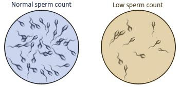 Zero sperm count after steroids
