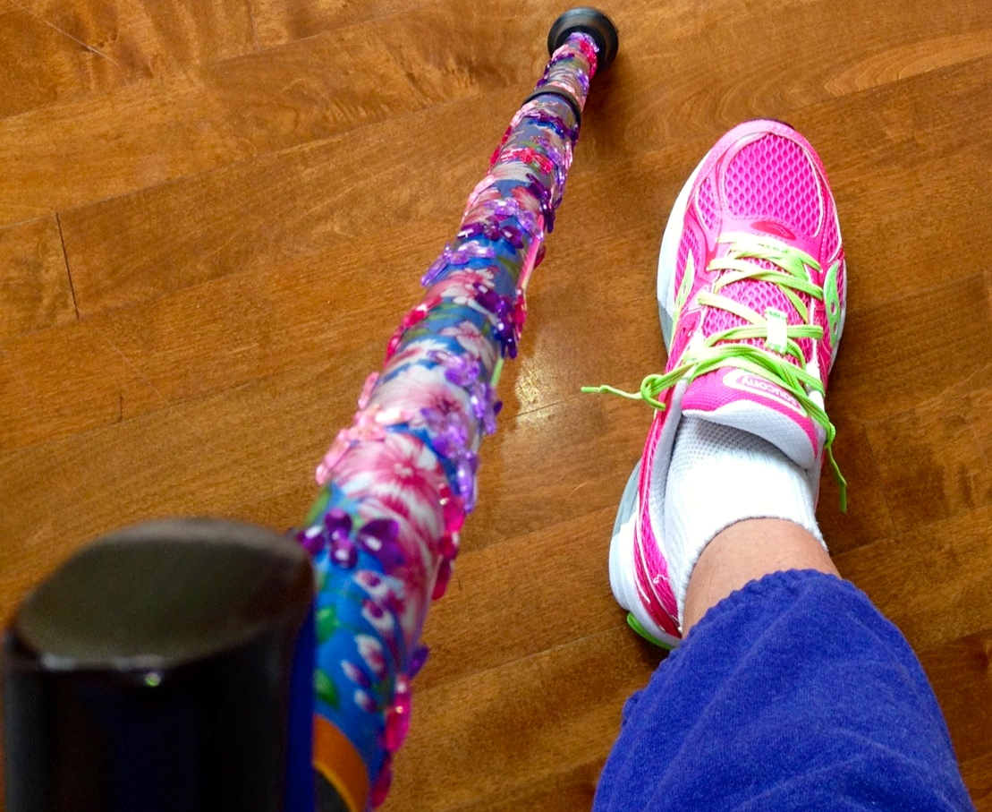 lisfranc boot lisfrancblog