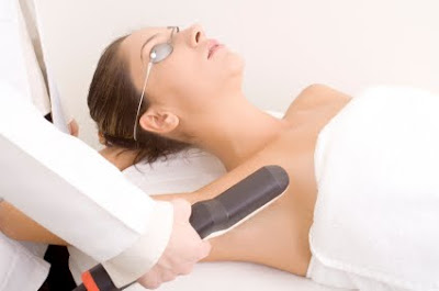 Laser Resurfacing Procedure