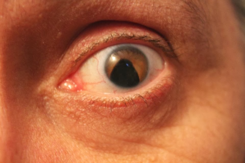 Peter Judge Varifocal Contact Lenses How Do They Work?