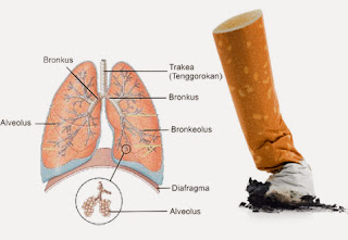 Cara membersihkan paru-paru dari asap rokok