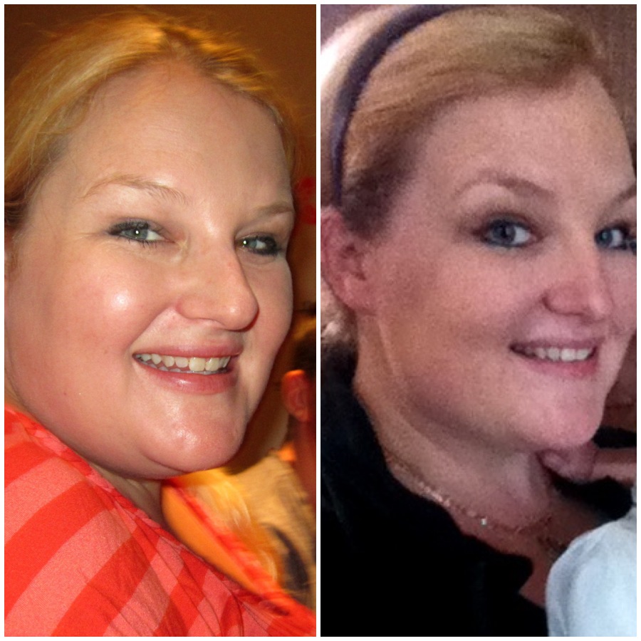 COCO BUTTER Before & After Photos