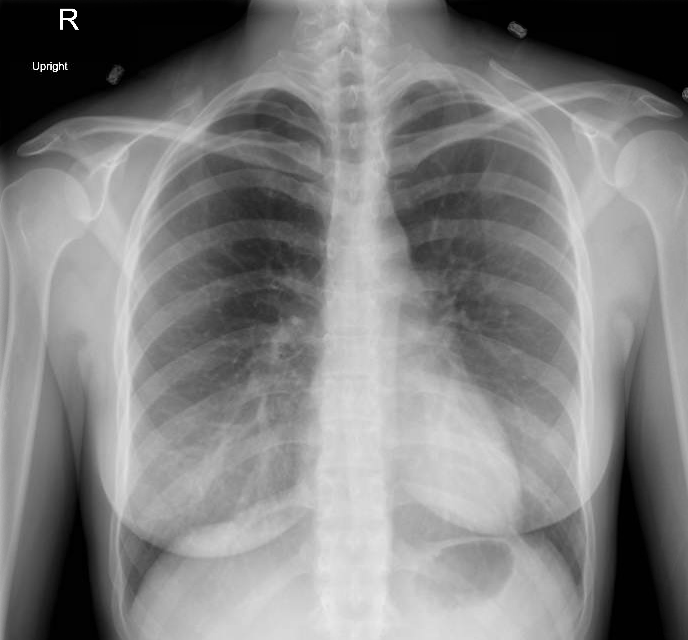 Emergency Medicine Visual Diagnosis My Shoulder Really Hurts...