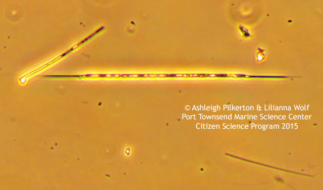 Pseudo-nitzschia image under the microscope.