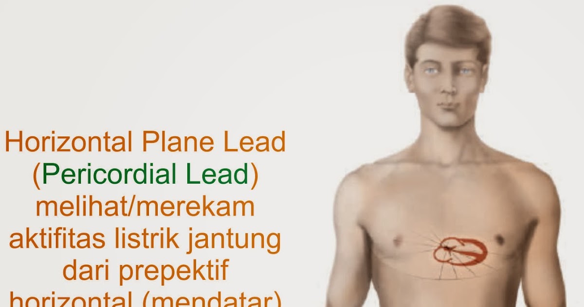 Horizontal Plane Lead (Precordial Plane Lead)